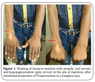 Figure 1.  